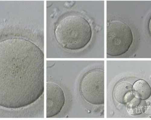 上海代生代怀试管,二代试管如何取精(试管婴儿是如何取精子的？)_冻胚移植打