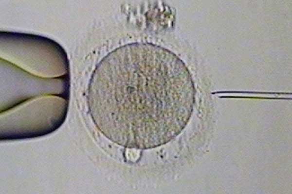 俄罗斯试管婴儿基因检测对囊胚会有伤害吗？